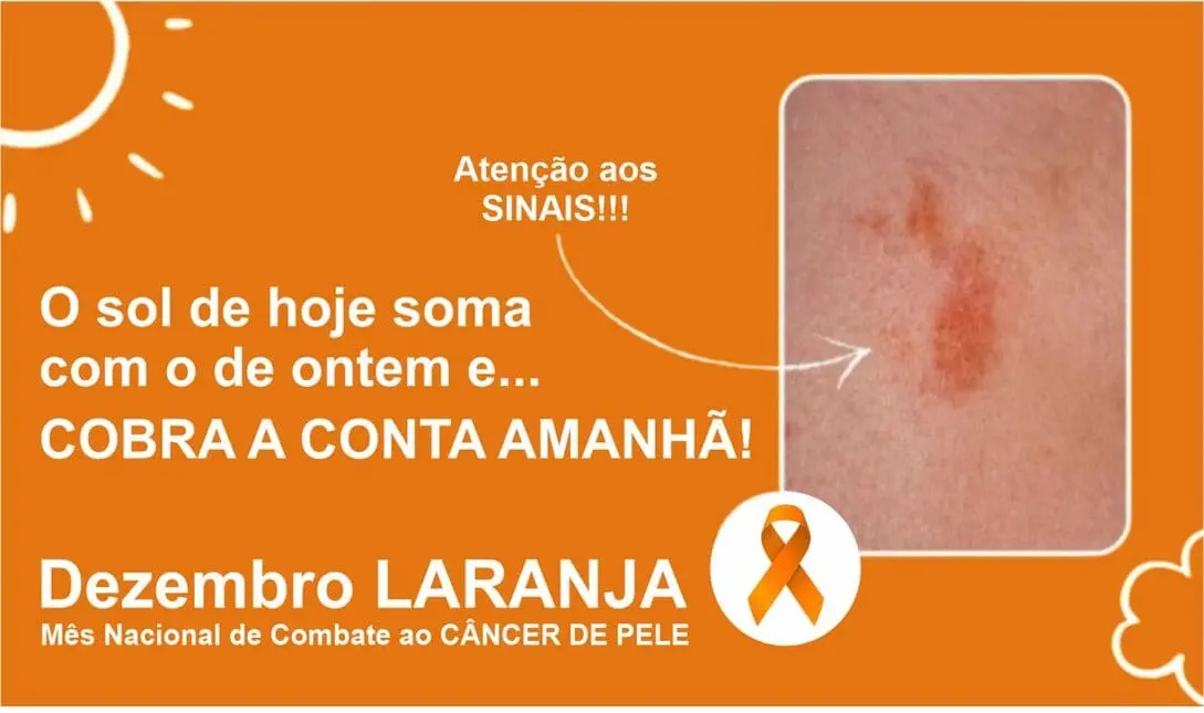 ALMANAQUE-DO-ESTUDANTE-Imagem-para-o-artigo-Dezembro-Laranja-11-Anos-Depois-Por-Que-o-Brasileiro-Ainda-Ignora-o-Cancer-de-Pele-I.webp