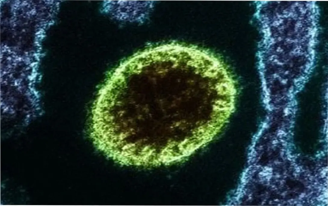 ALMANAQUE-DO-ESTUDANTE-Imagem-Para-o-Artigo-Virus-Nipah-O-Patogeno-Mortal-Que-Assusta-Profissionais-de-Saude-e-Acende-Alerta-Global.webp