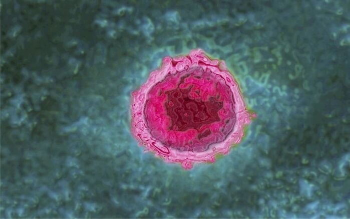 ALMANAQUE-DO-ESTUDANTE-Imagem-Para-o-Artigo-COVID-19-pode-acordar-virus-adormecidos-dentro-do-nosso-corpo-I.jpg